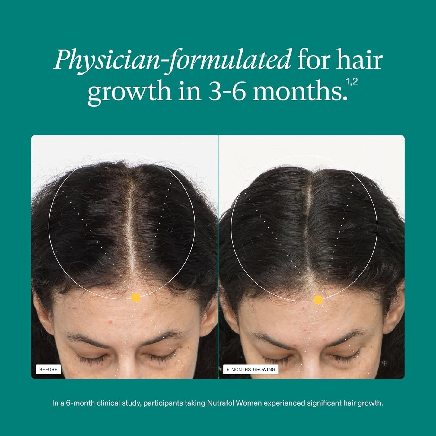 Nutrafol Women's Balance Hair Growth Supplements, Ages 45 and Up, Clinically Proven for Visibly Thicker Hair and Scalp Coverage, Dermatologist Recommended - 1 Month Supply